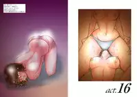 [Moewrest (Meto)] Moewrest 9 Meganekko Shoubu - Ai vs Risa 5 Final